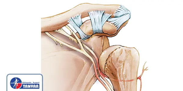 دررفتگی شانه