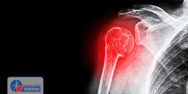 در رفتن شانه