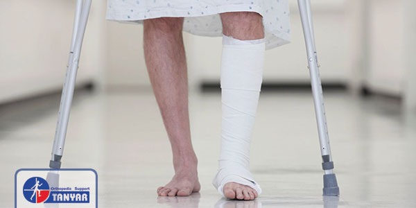 راه رفتن با پای گچ گرفته