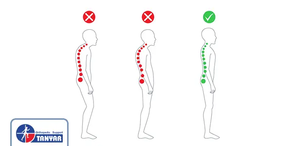 نحوه صحیح ایستادن
