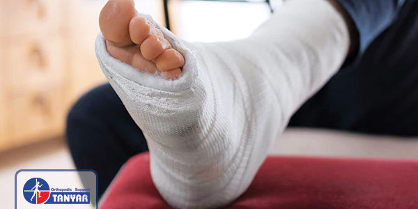 پای گچ گرفته