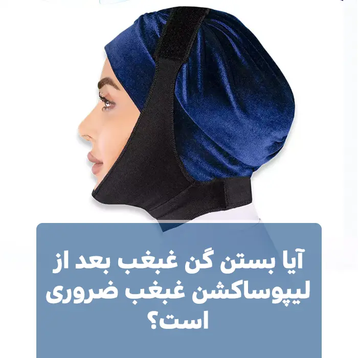 آیا بستن گن غبغب بعد از لیپوساکشن غبغب ضروری است؟