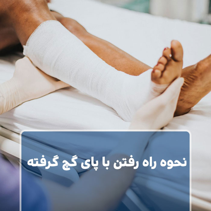 راه رفتن با پای گچ کرفته