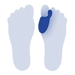 پد انجراف شست پا